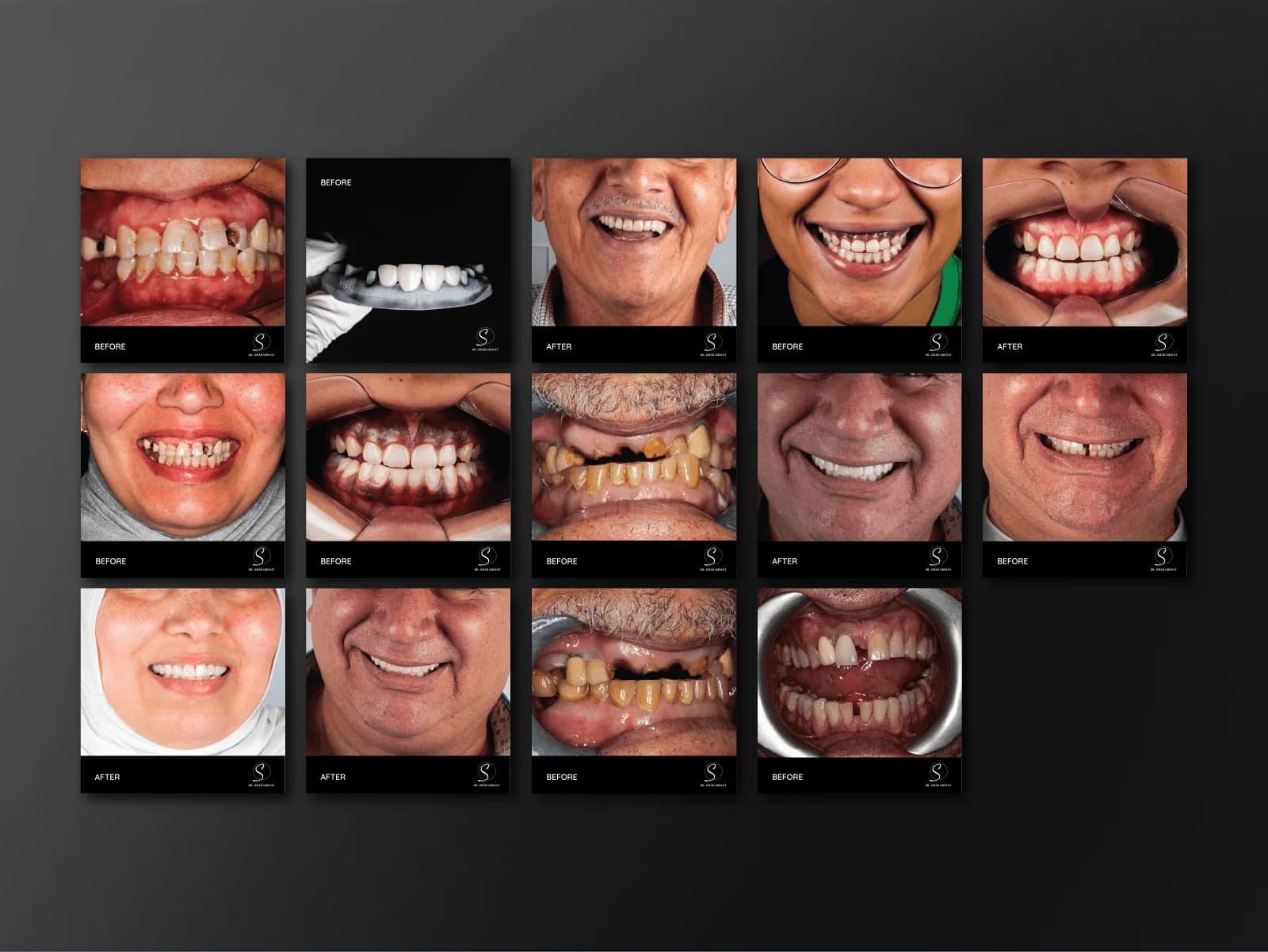 Grid of Dr. Omar Sarwat before-and-after dental patient case posts