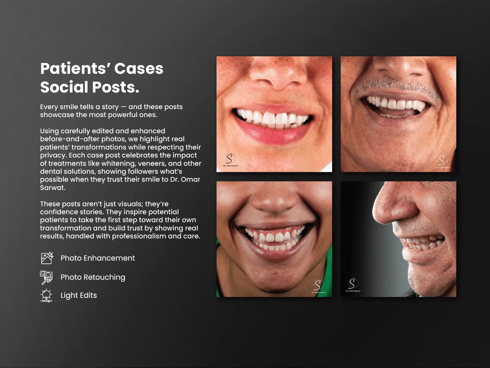 Dr. Omar Sarwat patient case social posts showing smile transformations